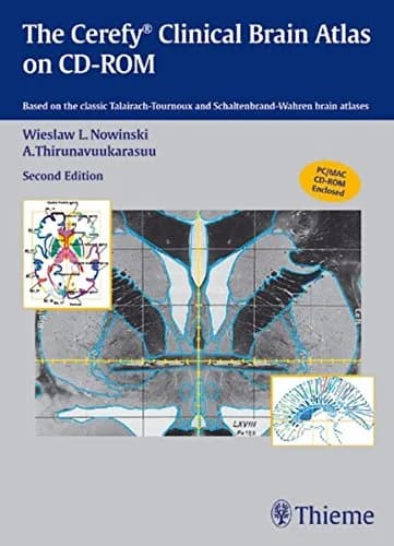 Image of - The Cerefy Clinical Brain Atlas/CD-ROM 2004 - 2nd Edition