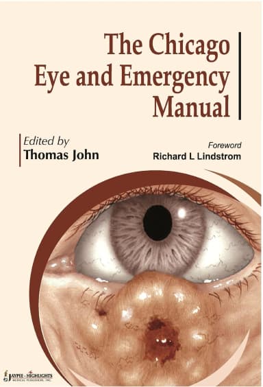 Image of - The Chicago Eye And Emergency Manual (Online Edition) - 1st Edition 2011