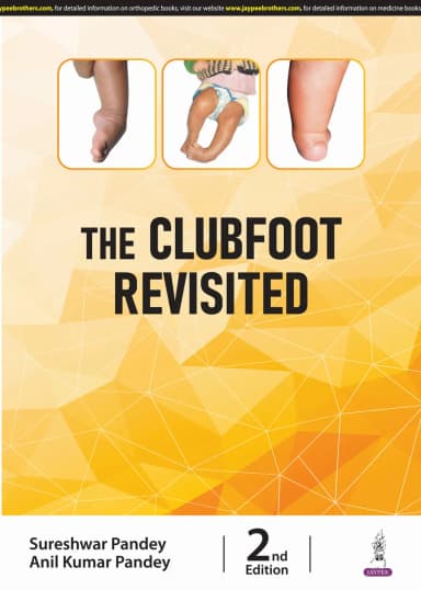 Image of - The Clubfoot Revisited