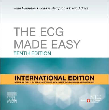 Image of - The ECG Made Easy (IE) - 10E