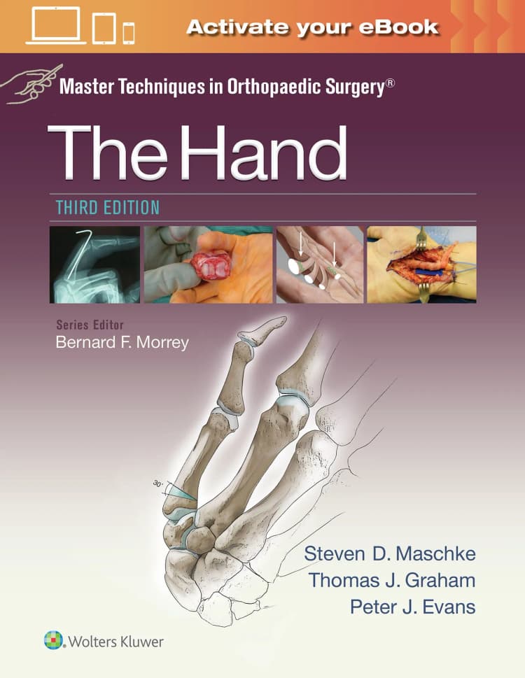 Master techniques in orthopaedic surgery - the hand