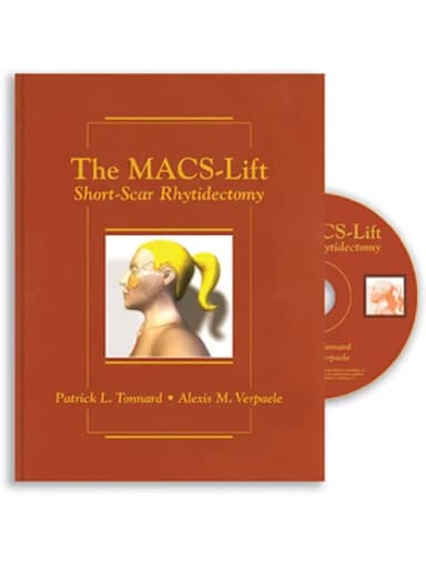 Image of - The MACS-Lift Short-Scar Rhytidectomy - 1st Edition