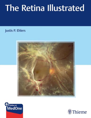 Image of - The Retina Illustrated 1st Ed.
