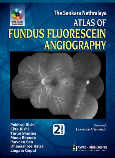 Image of - The Sankara Nethralaya | Atlas of Fundus Fluorescein Angiography