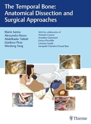 Image of - The Temporal Bone: Anatomical Dissection and Surgical Approaches: 1/e