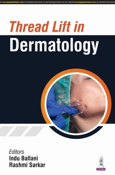 Image of - Thread Lift in Dermatology