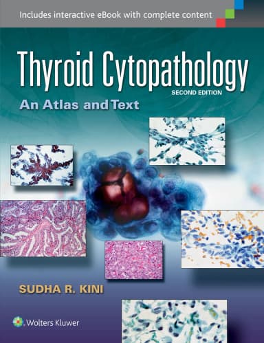 Image of - Thyroid Cytopathology:A Text and Atlas | 2nd Edition
