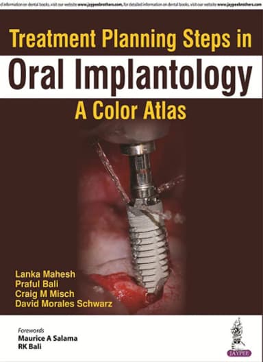Image of - Treatment Planning Steps in Oral Implantology | A Color Atlas