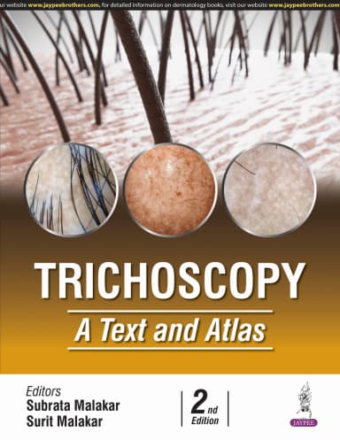Image of - Trichoscopy | A Text and Atlas
