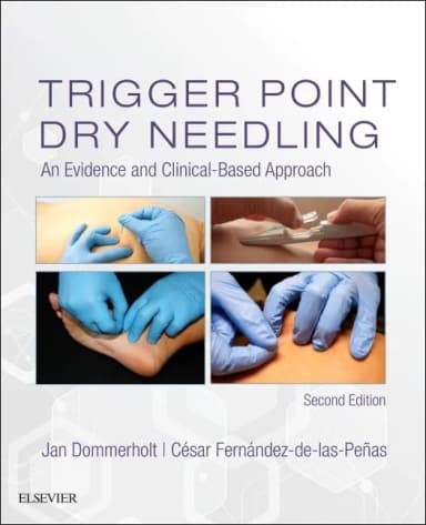 Image of - Trigger Point Dry Needling -2E