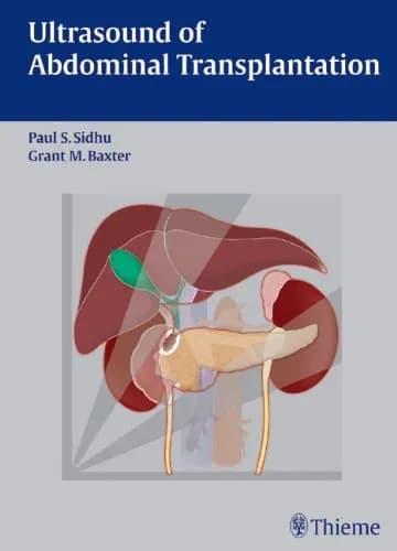 Image of - Ultrasound of Abdominal Transplantation - 1st Edition