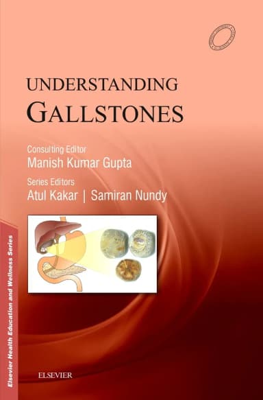 Image of - Understanding Gallistones - 1E