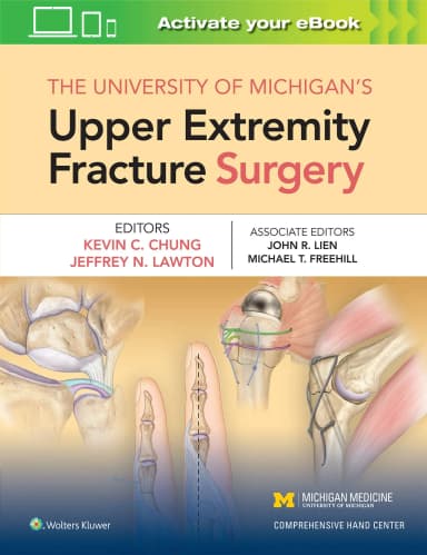 Image of - The University of Michigans Upper Extremity Fracture Surgery - 1st Edition