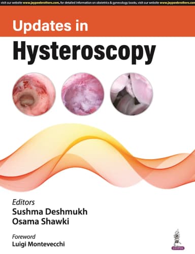 Image of - Updates in Hysteroscopy