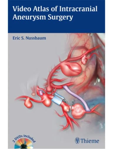 Image of - Video Atlas of Intracranial Aneurysm Surgery - 1st Edition