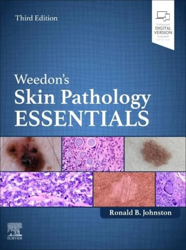 Image of - Weedon's Skin Pathology Essentials-3E