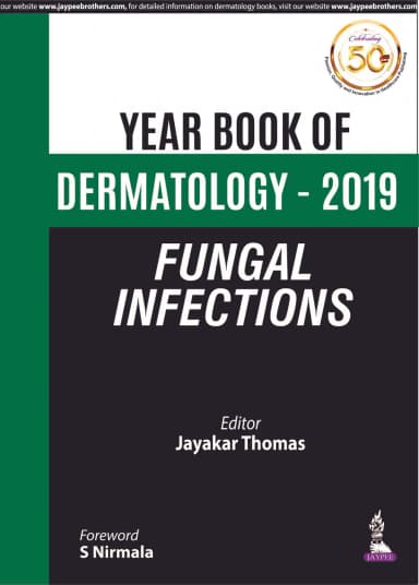 Image of - Year Book of Dermatology â 2019 Fungal Infections