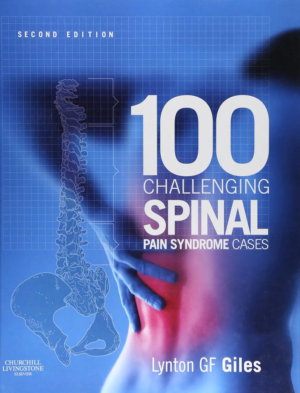 100 Challenging Spinal Pain Syndrome Cases | 2nd Edition | Hardcover