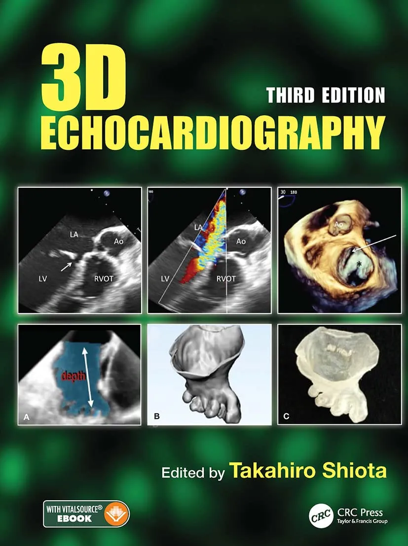 3D Echocardiography | Third Edition | Hardcover