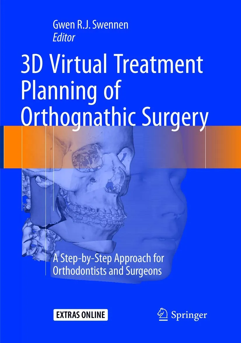 3D Virtual Treatment Planning Of Orthognathic Surgery A Step By Step Approach For Orthodontists And Surgeons | Paperback