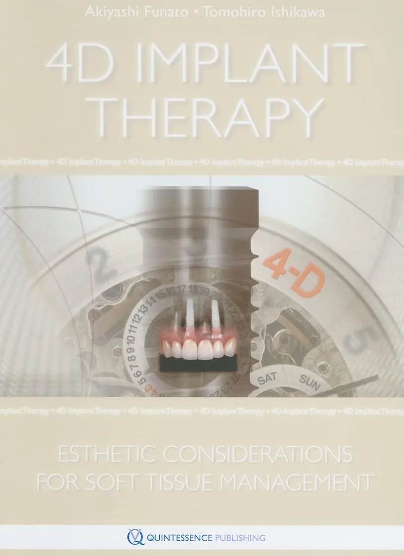 4D Implant Therapy Esthetic Considerations for Soft Tissue Management | Hardcover