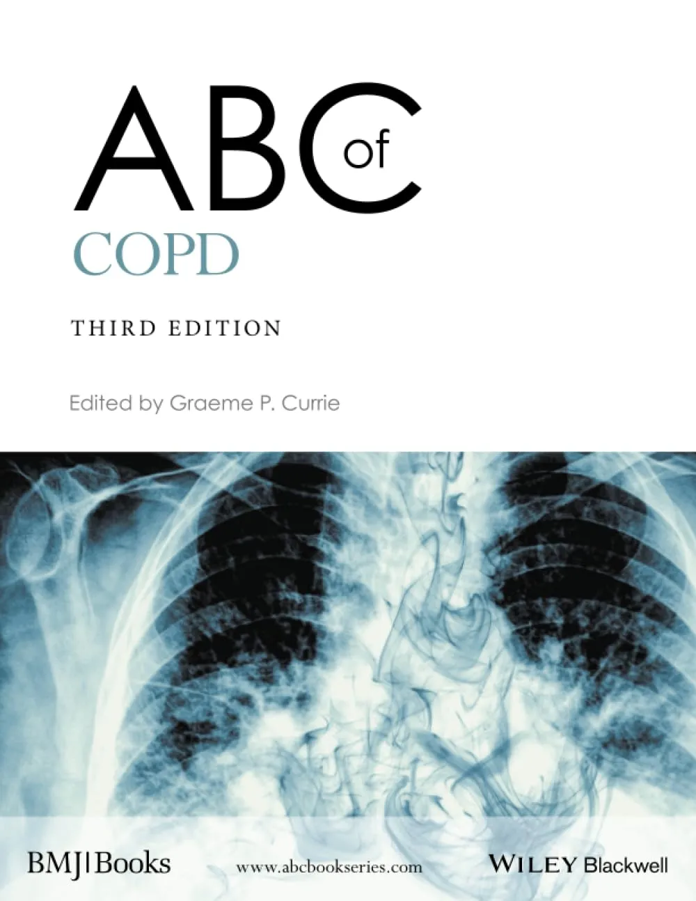 ABC of COPD | Third Edition | Paperback