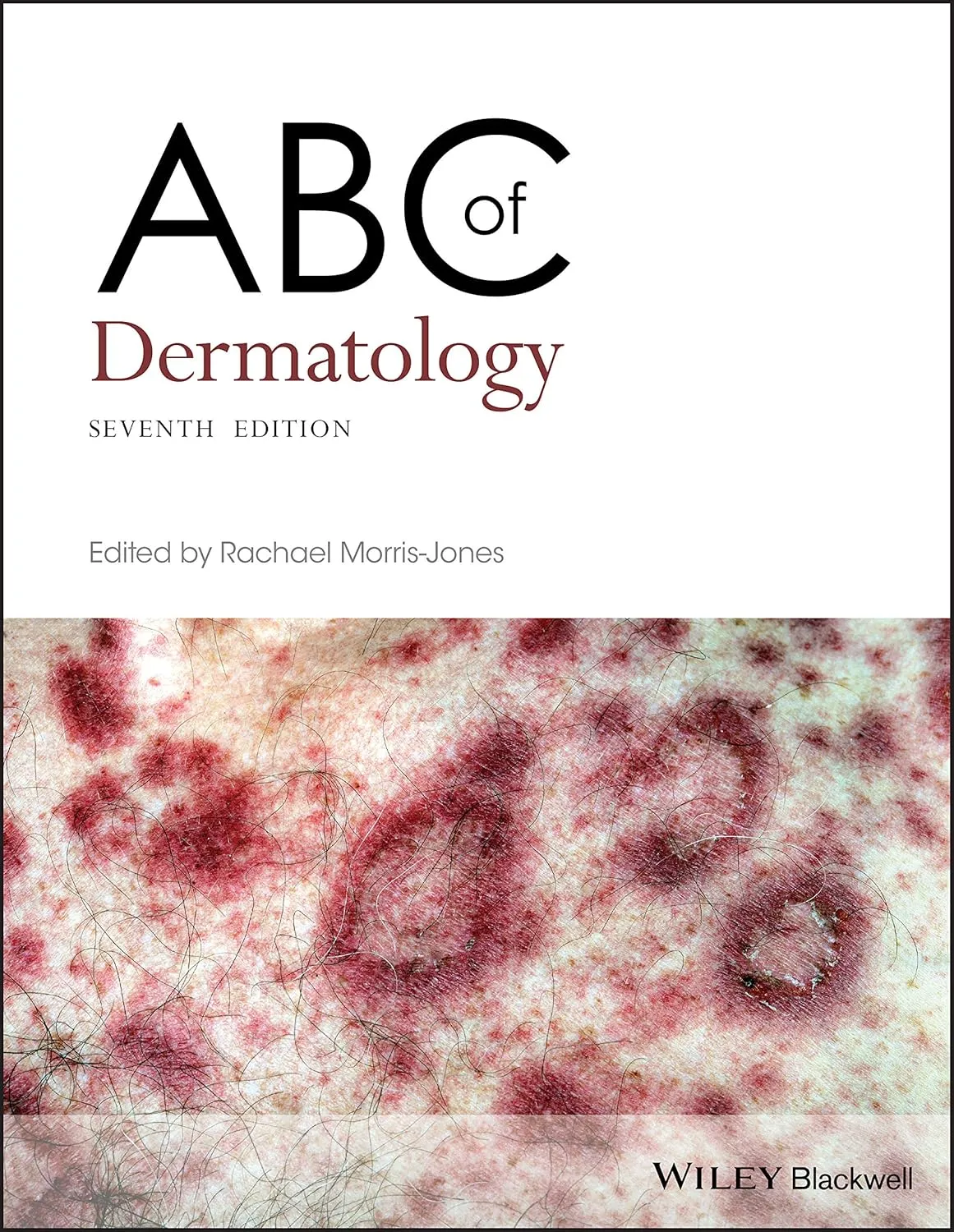 ABC of Dermatology 7th Edition | Paperback