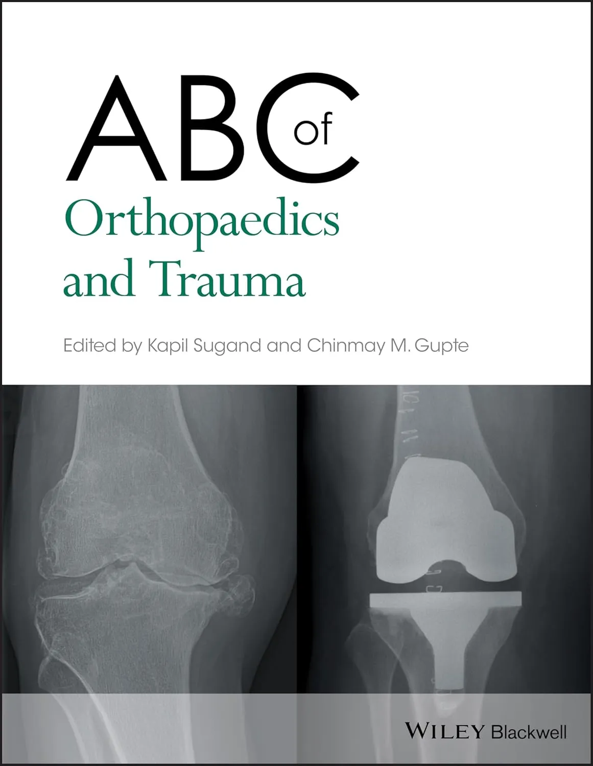 Abc Of Orthopaedics And Trauma | Paperback