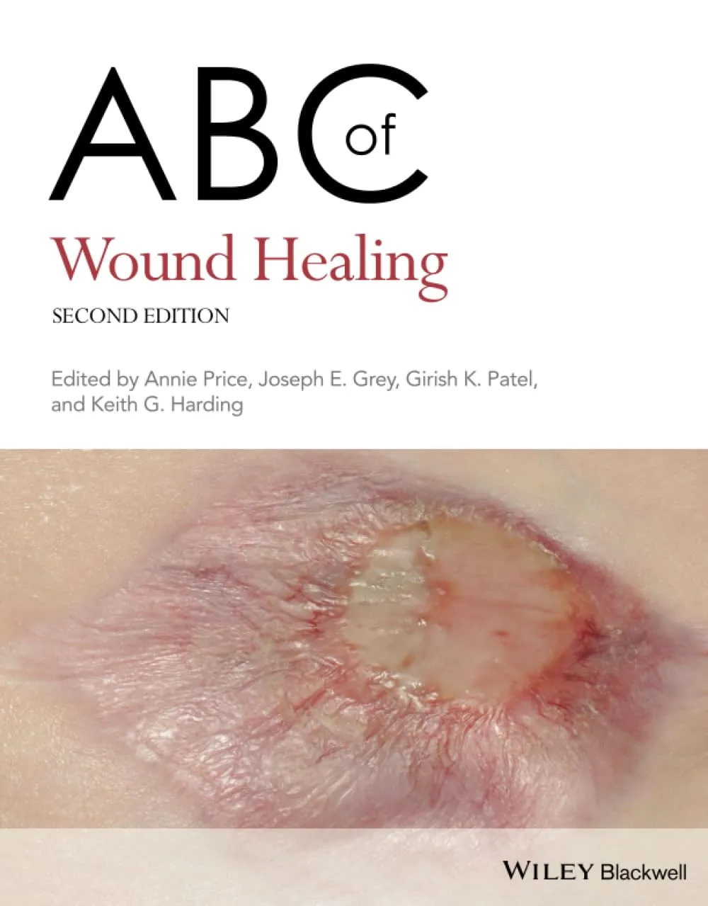 ABC Of Wound Healing 2nd Edition | Paperback