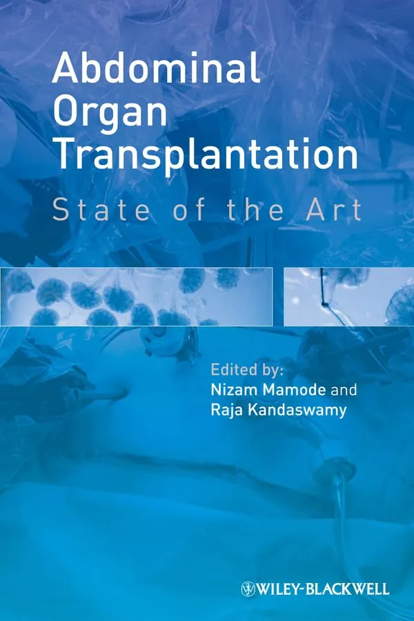 Abdominal Organ Transplantation State of the Art | Hardcover
