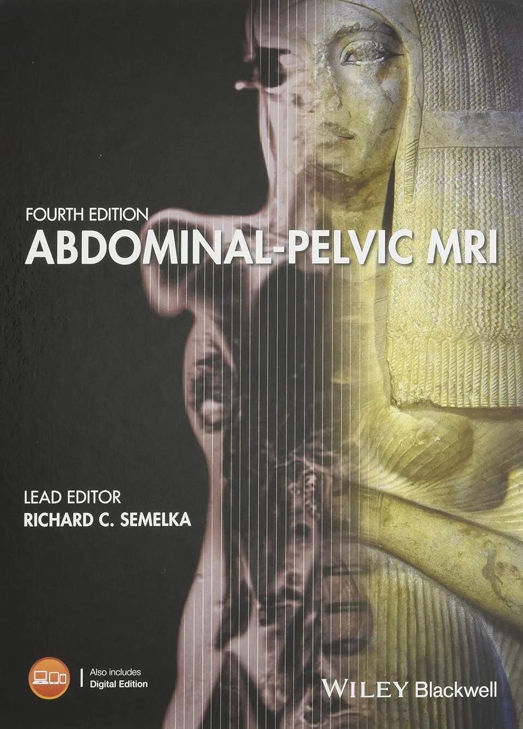 Abdominal-Pelvic MRI | 4th Edition | Hardcover