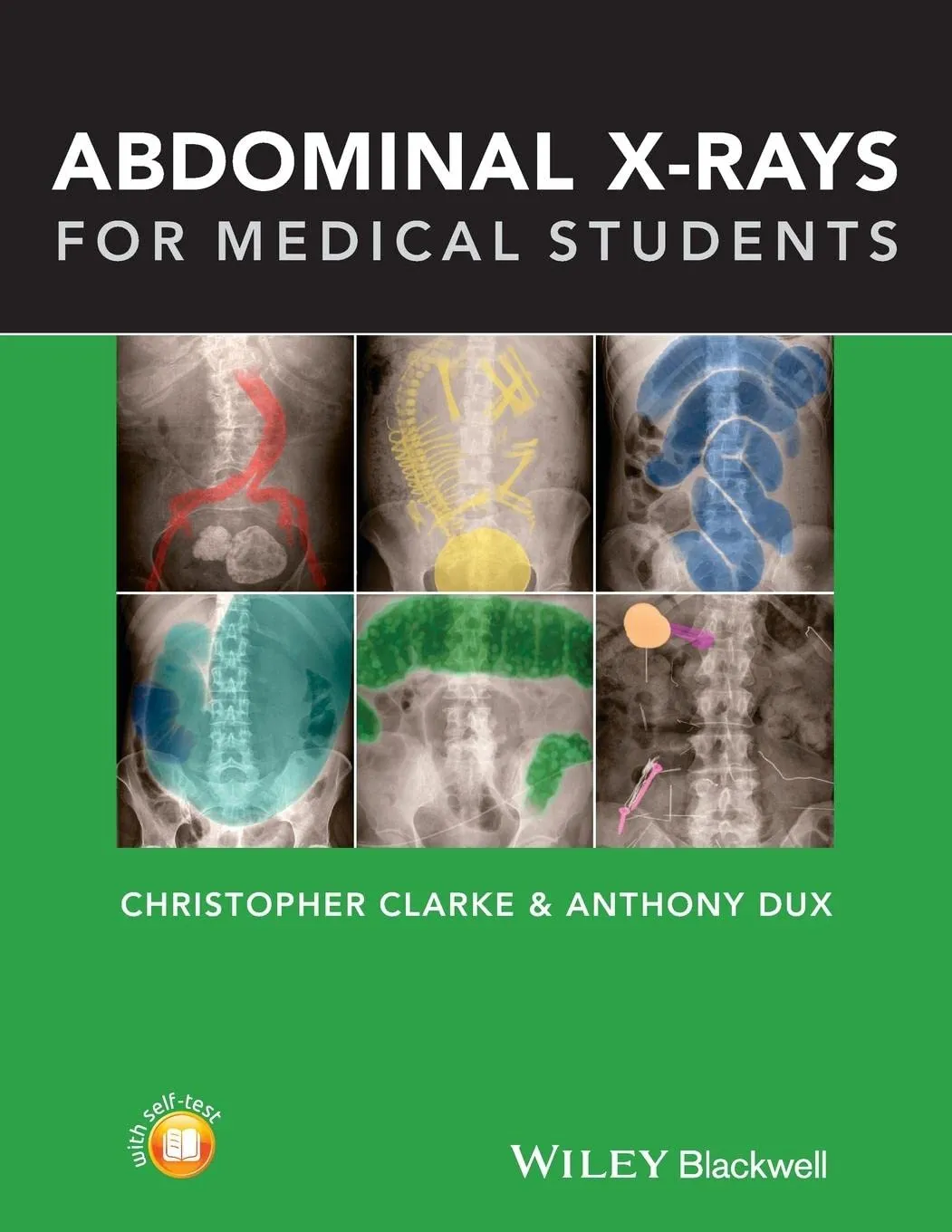 Abdominal X-Rays for Medical Students | Paperback