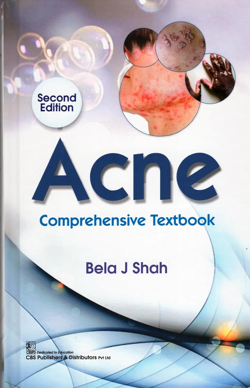 Acne Comprehensive Textbook 2nd Editiond | Hardcover