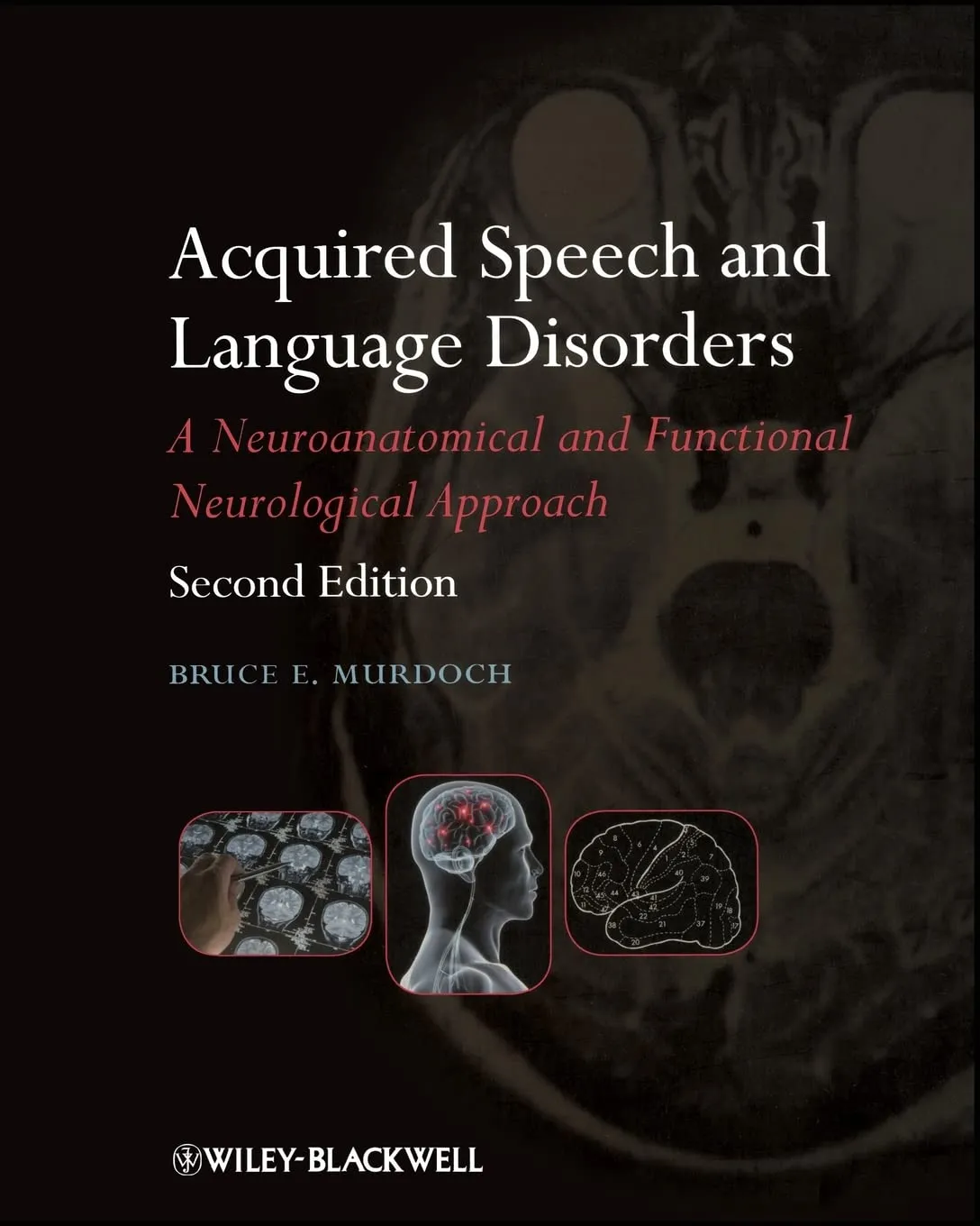Acquired Speech and Language Disorders A Neuroanatomical and Functional Neurological Approach | 2nd Edition | Paperback