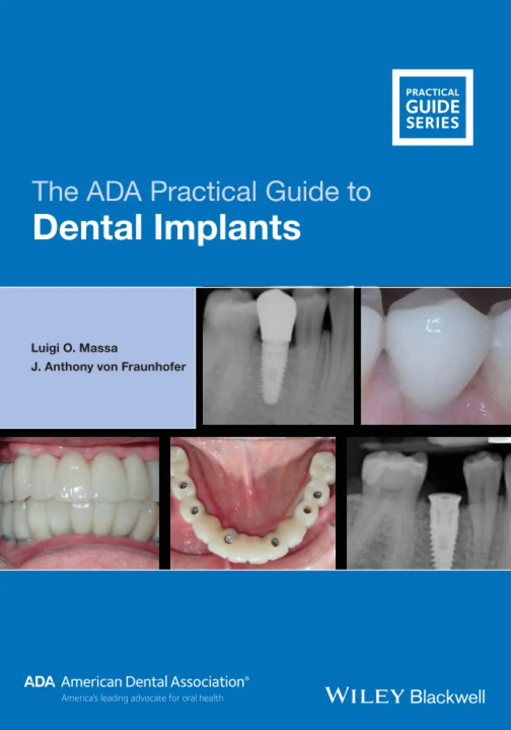 The Ada Practical Guide To Dental Implants | Paperback