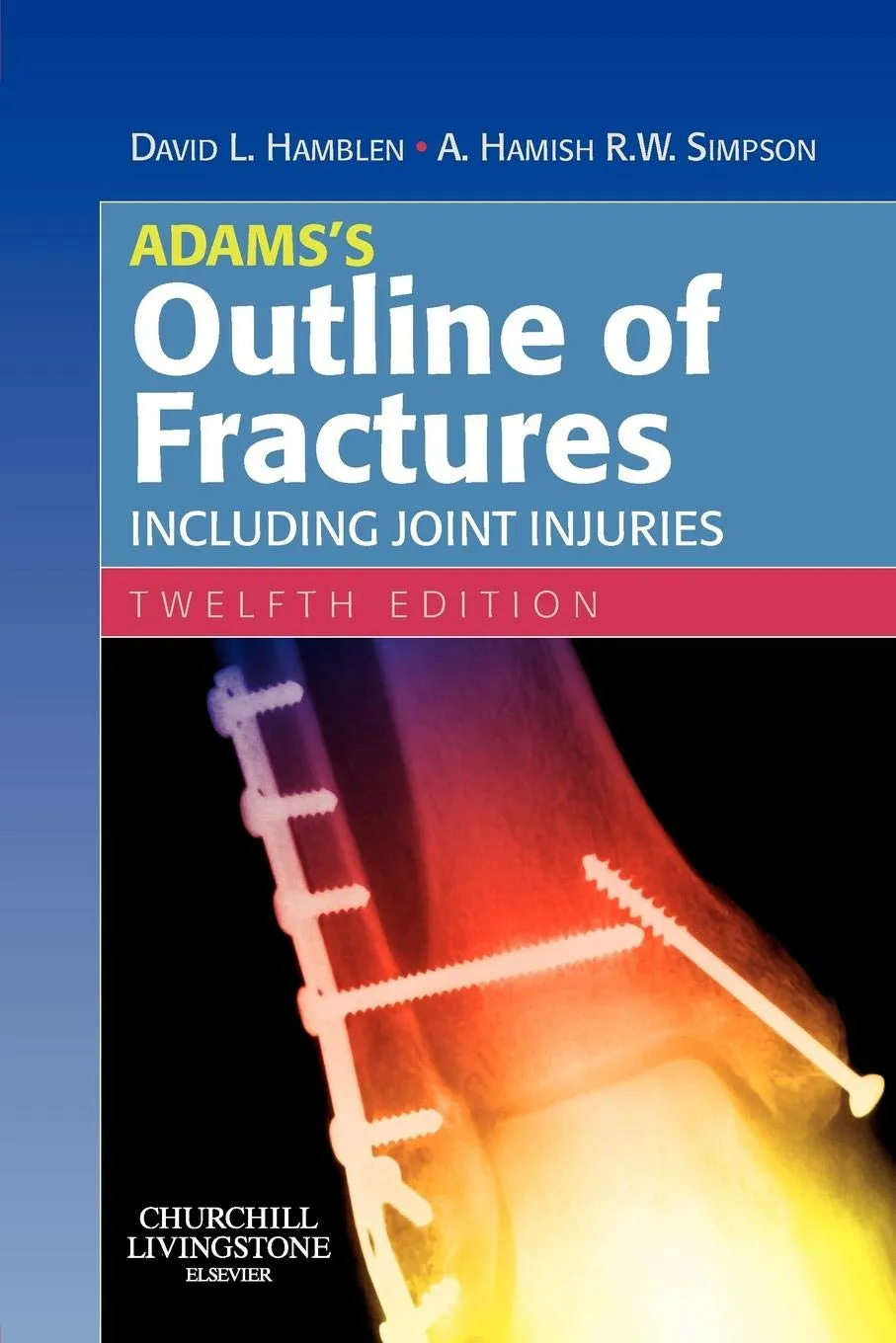 Adams Outline Of Fractures Including Joint Injuries 12nd Edition | Paperback