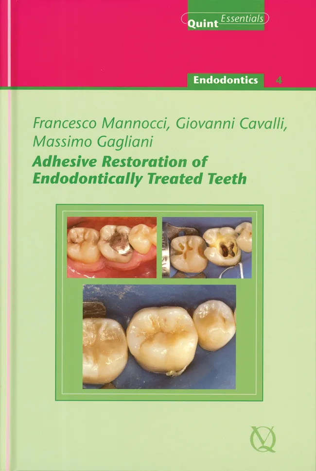 Adhesive Restoration of Endodontically Treated Teeth | Hardcover