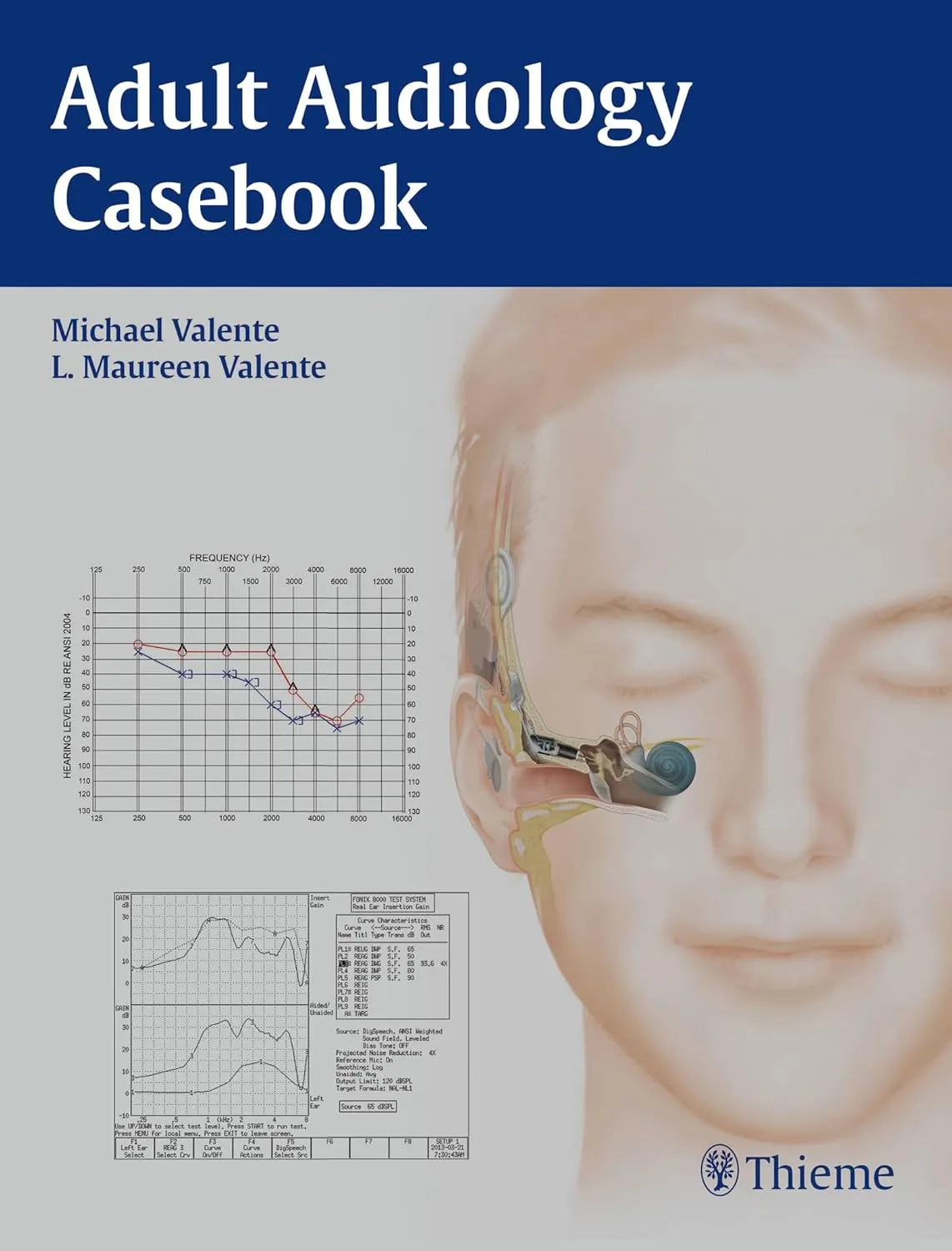 Adult Audiology Casebook | 1st Edition | Paperback