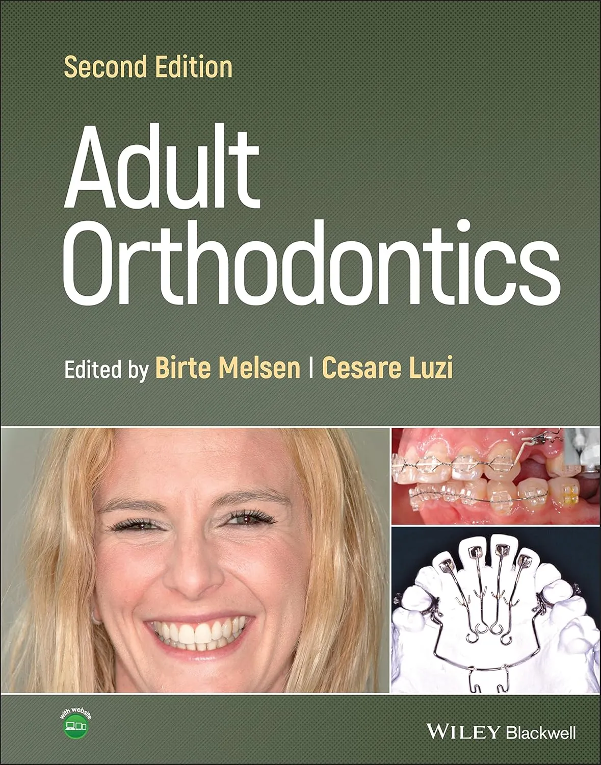Adult Orthodontics | 2nd Edition | Hardcover