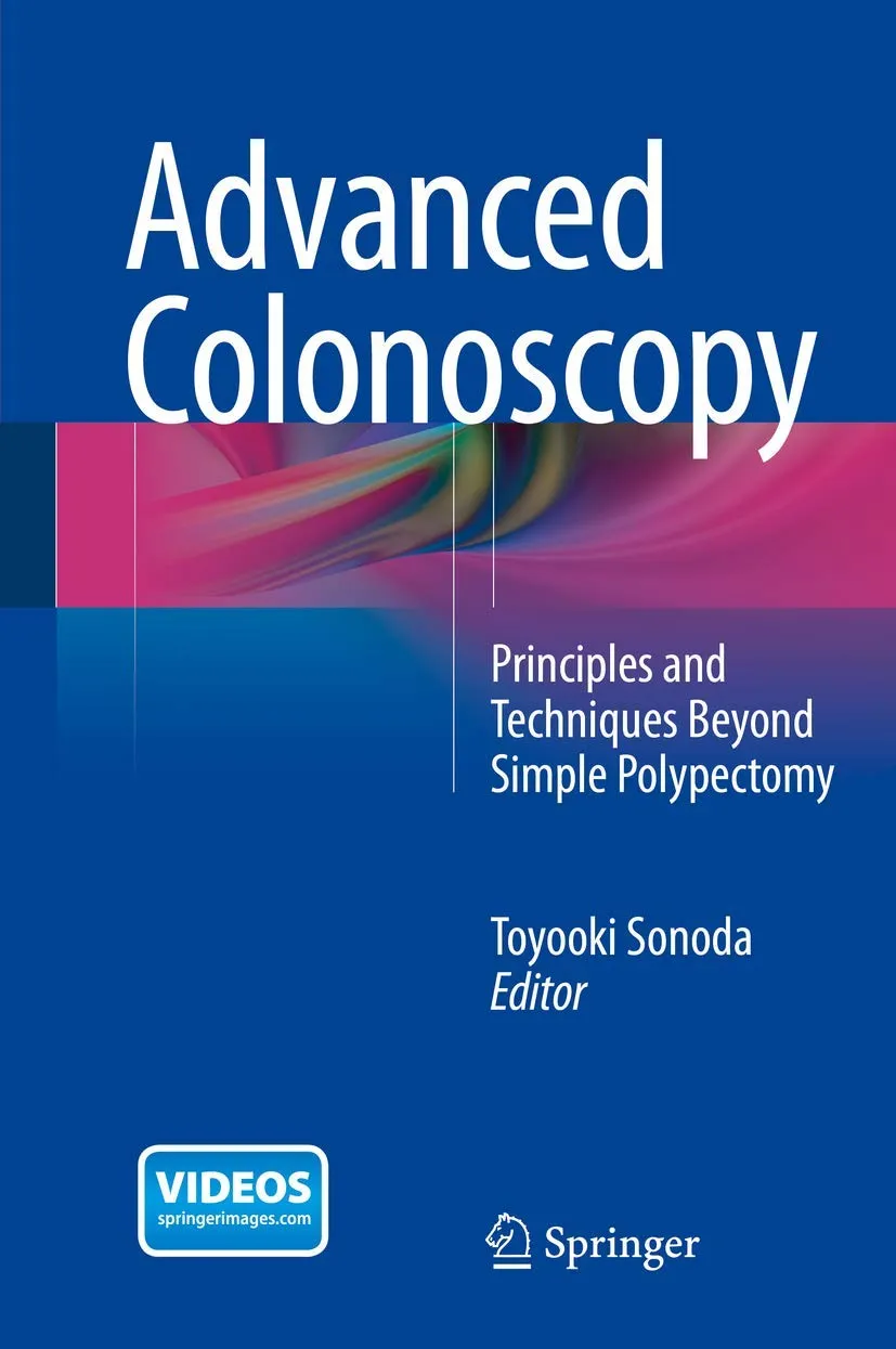 Advanced Colonoscopy Principles and Techniques Beyond Simple Polypectomy | Hardcover