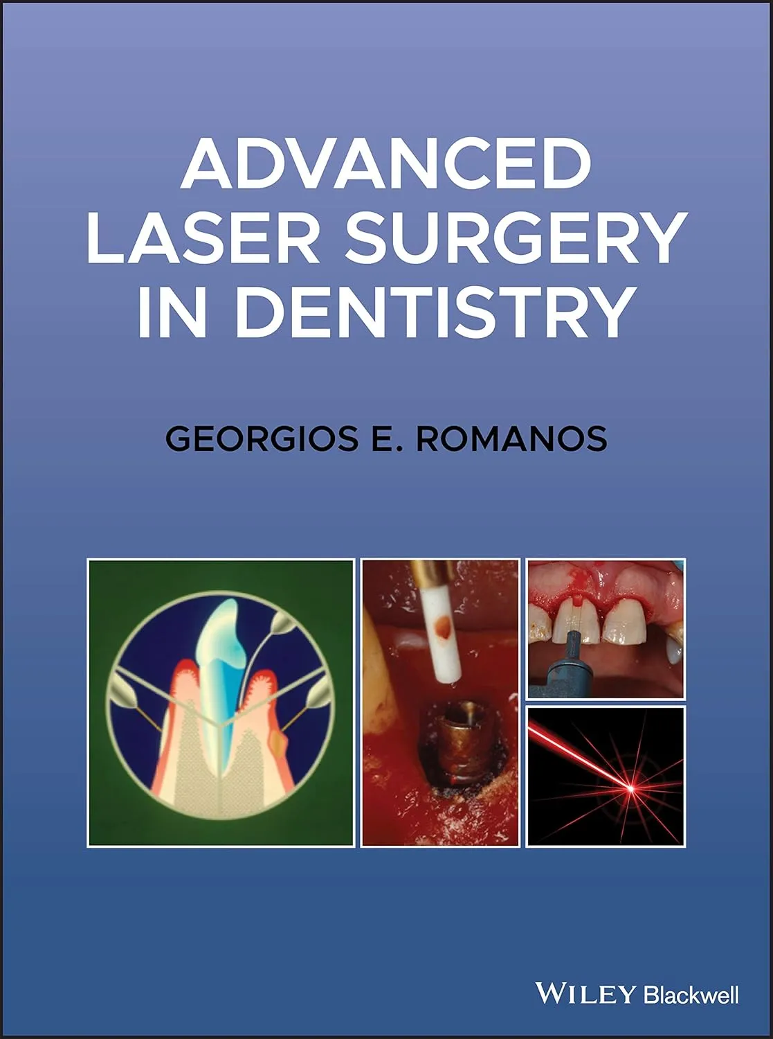 Advanced Laser Surgery In Dentistry | Hardcover