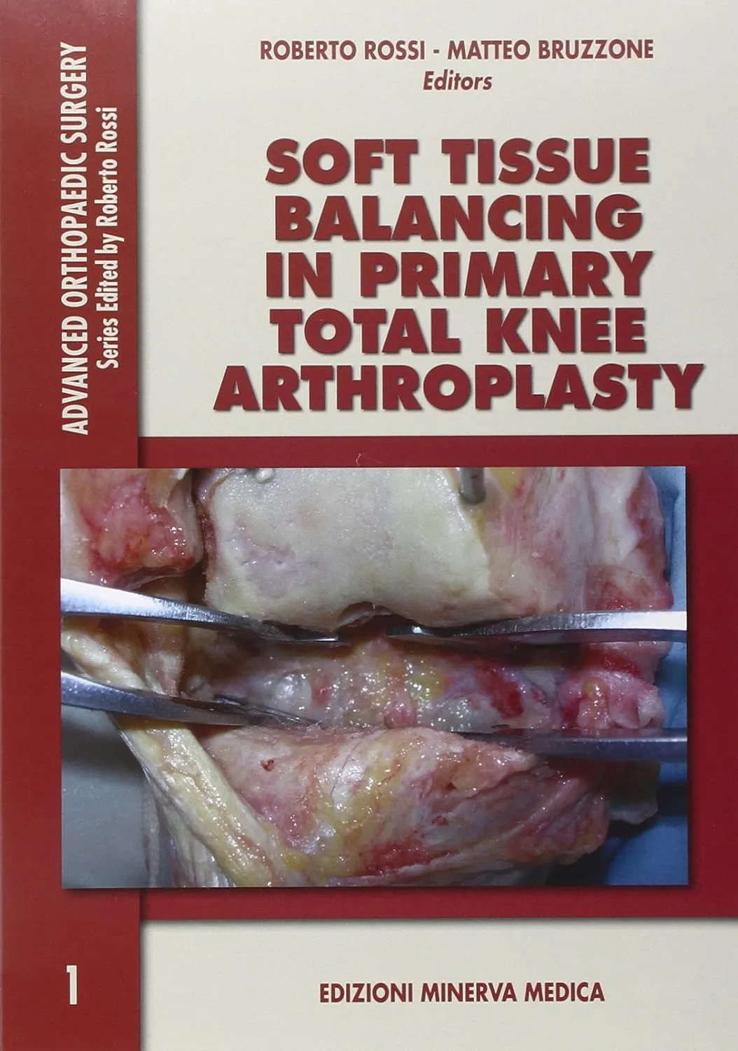 Advanced Orthopaedic Surgery Soft Tissue Balancing in Primary Total Knee Arthroplasty | Paperback