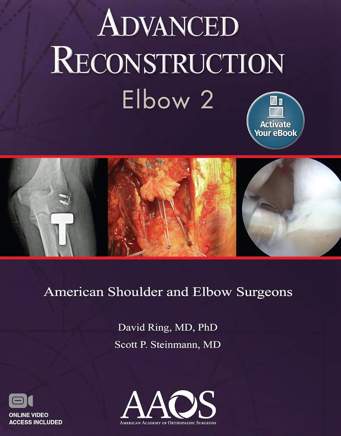 Advanced Reconstruction Elbow 2 | Paperback