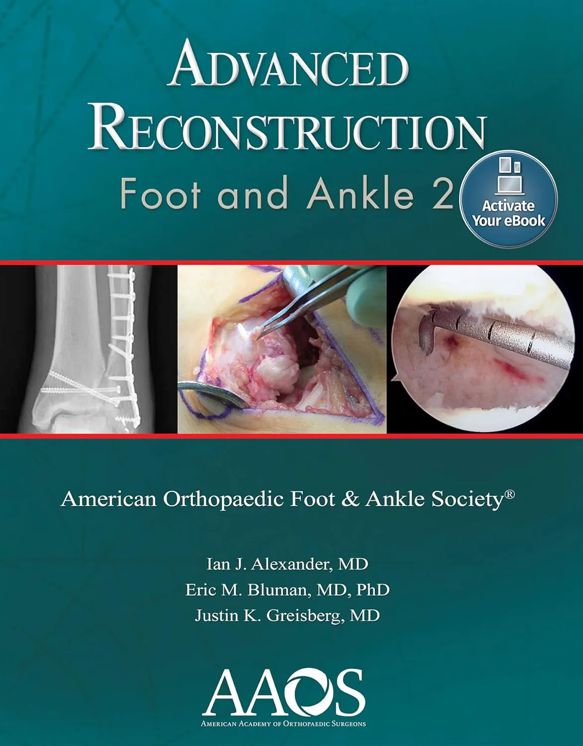 Advanced Reconstruction Foot and Ankle 2 | Paperback
