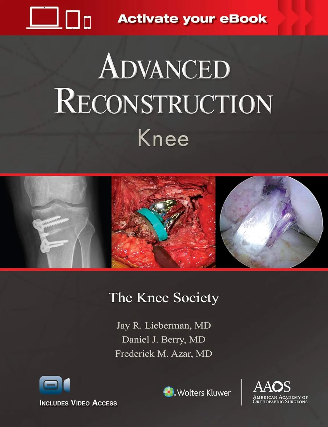 Advanced Reconstruction Knee | With DVD | Hardcover