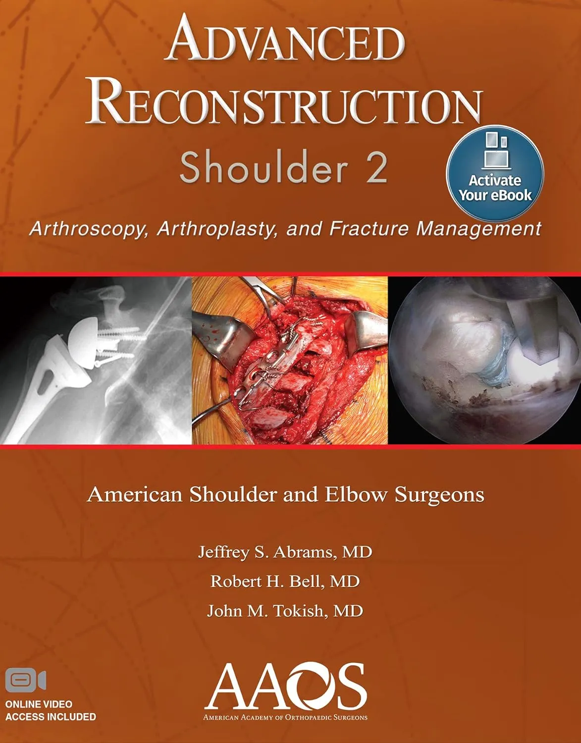 Advanced Reconstruction Shoulder 2 | Paperback