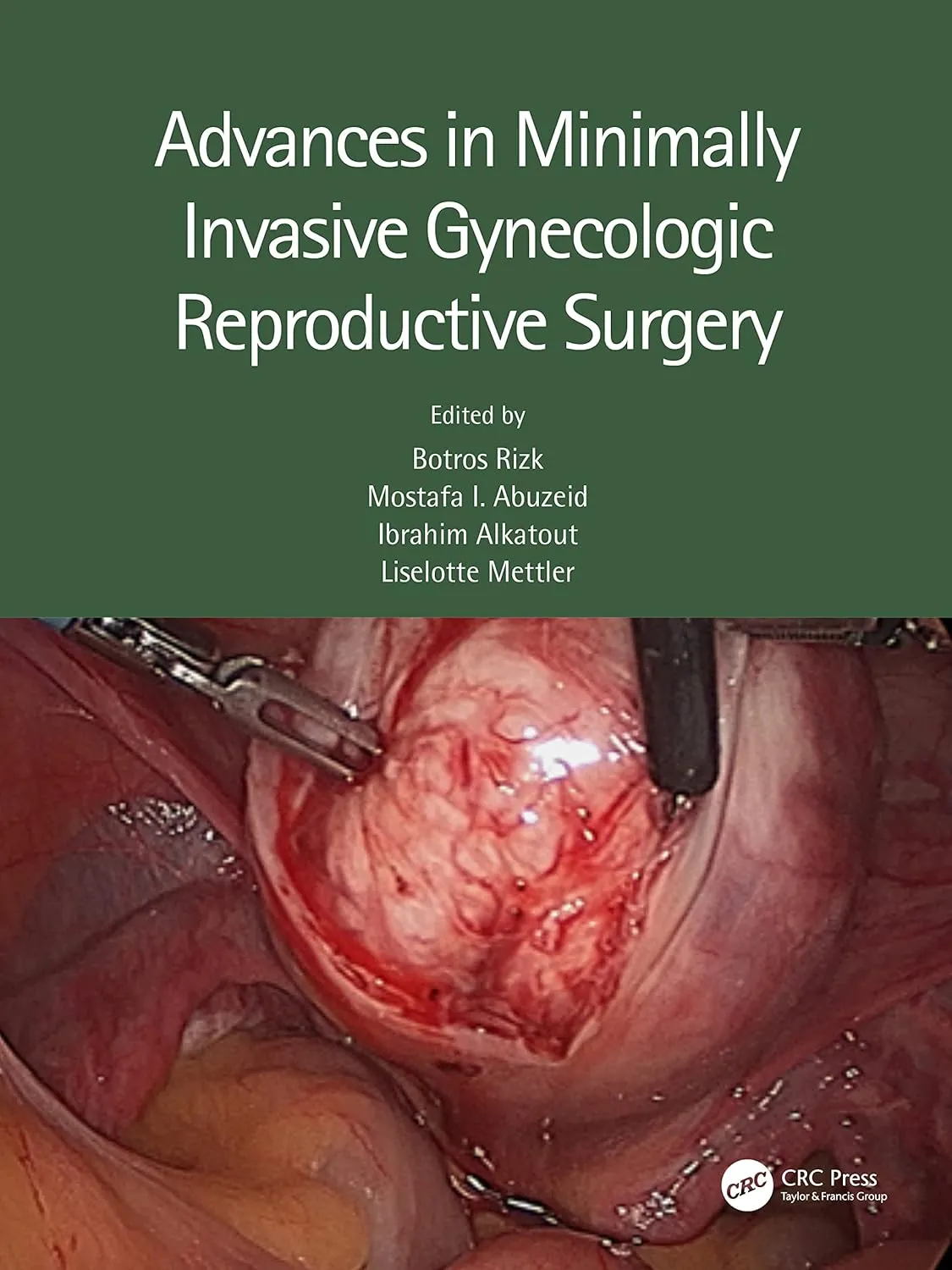 Advances In Minimally Invasive Gynecologic Reproductive Surgery | Hardcover