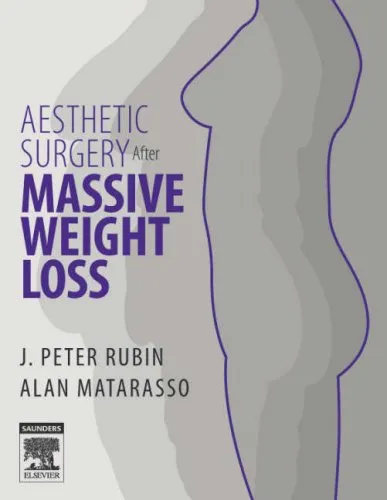 Aesthetic Surgery after Massive Weight Loss | Hardcover