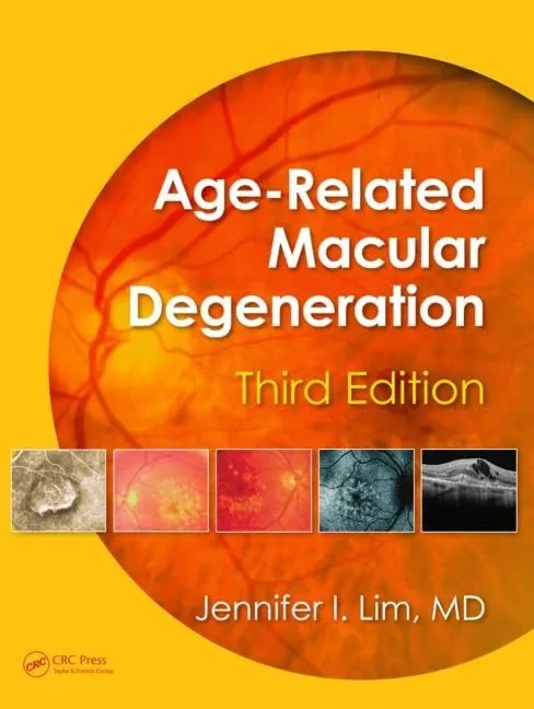 Age-Related Macular Degeneration | Third Edition | Hardcover