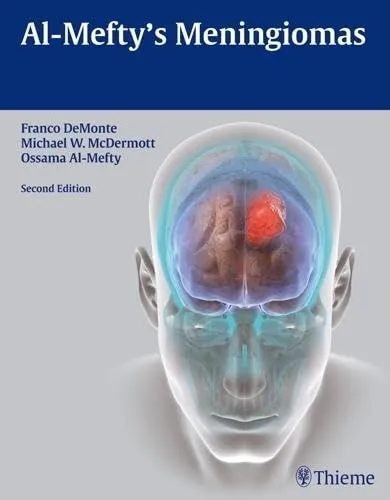 Al-Mefty's Meningiomas | Hardcover